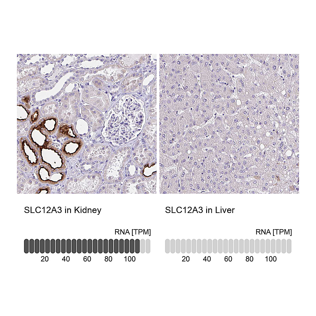 Atlas Antibodies Anti-SLC12A3 Antibody