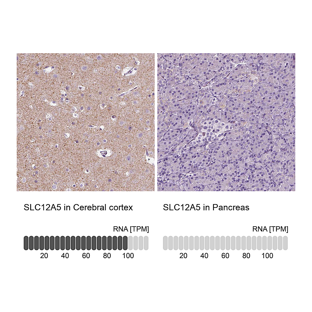 Atlas Antibodies Anti-SLC12A5 Antibody
