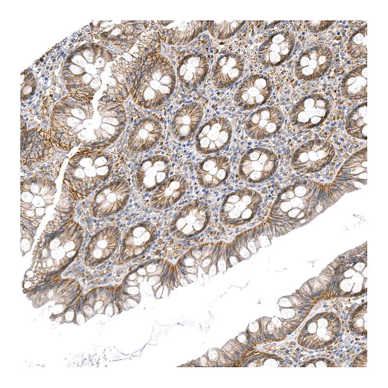 Atlas Antibodies Anti-SLC12A7 Antibody