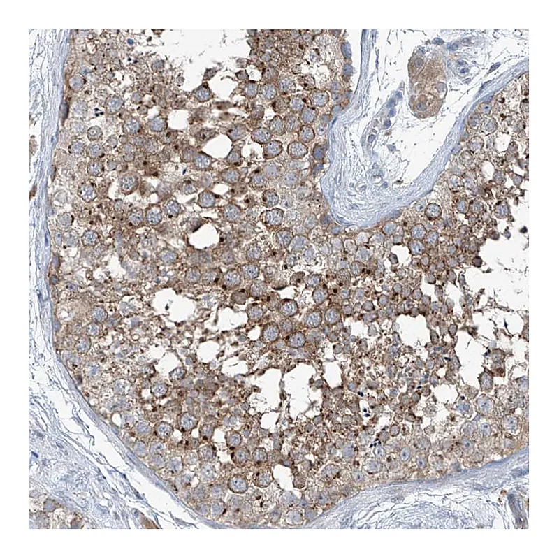 Atlas Antibodies Anti-SLC12A6 Antibody