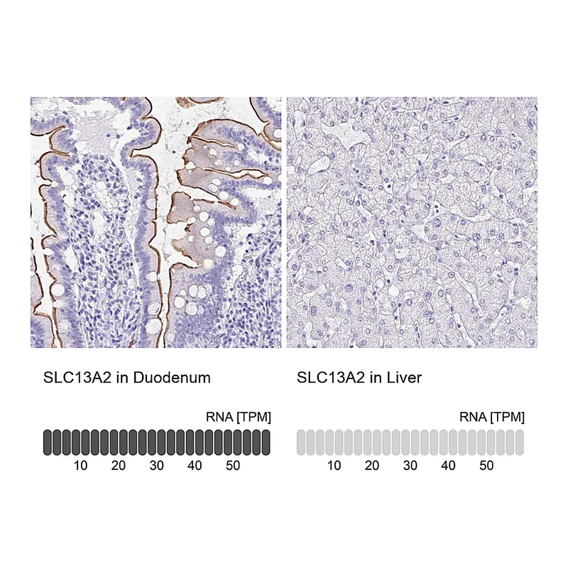 Atlas Antibodies Anti-SLC13A2 Antibody