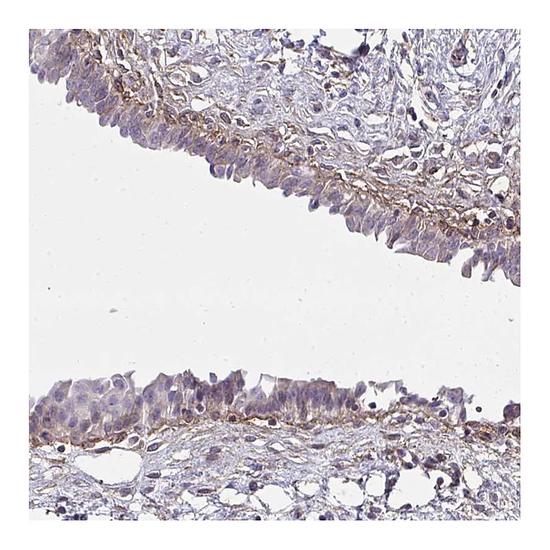 Atlas Antibodies Anti-SLC14A1 Antibody