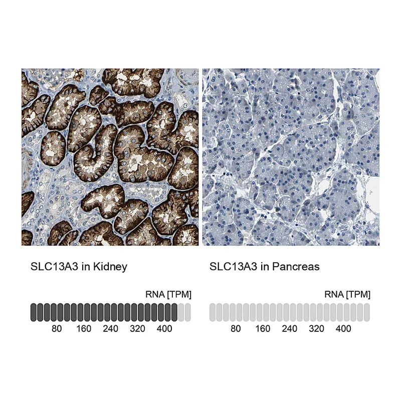 Atlas Antibodies Anti-SLC13A3 Antibody