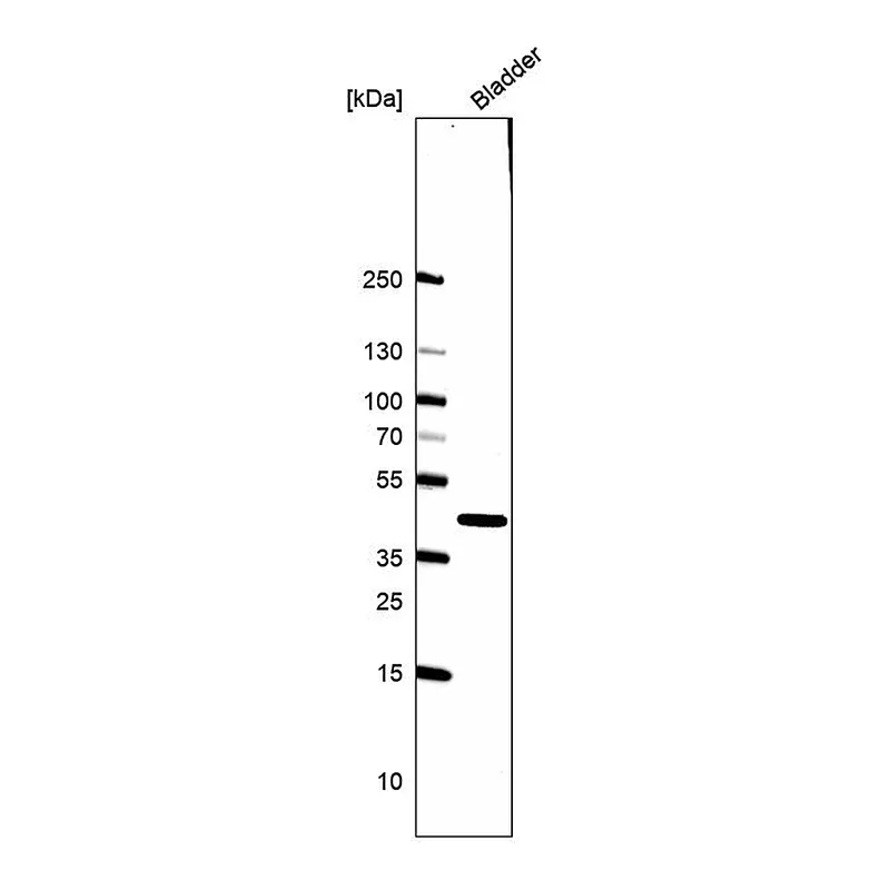 Atlas Antibodies Anti-SLC14A1 Antibody