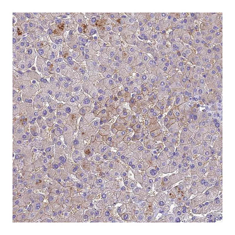 Atlas Antibodies Anti-SLC13A5 Antibody