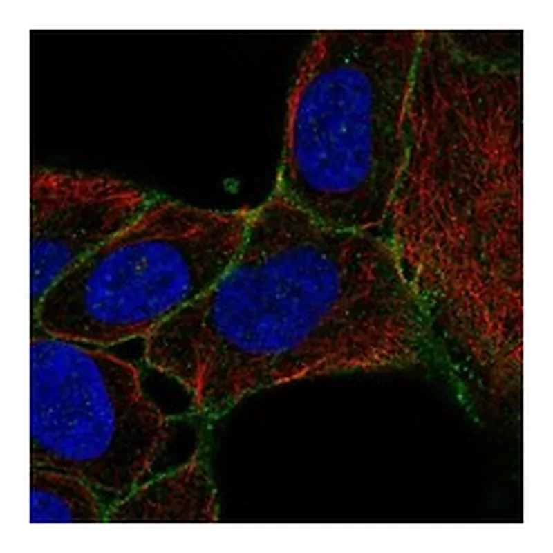 Atlas Antibodies Anti-SLC14A1 Antibody