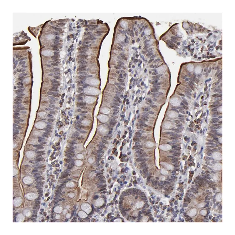 Atlas Antibodies Anti-SLC15A1 Antibody