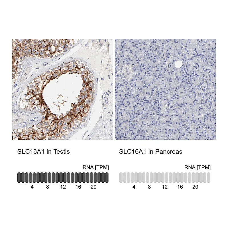 Atlas Antibodies Anti-SLC16A1 Antibody