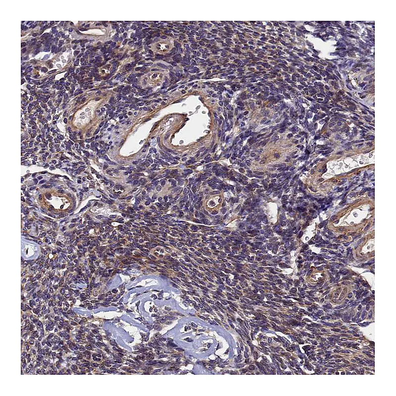 Atlas Antibodies Anti-SLC16A14 Antibody