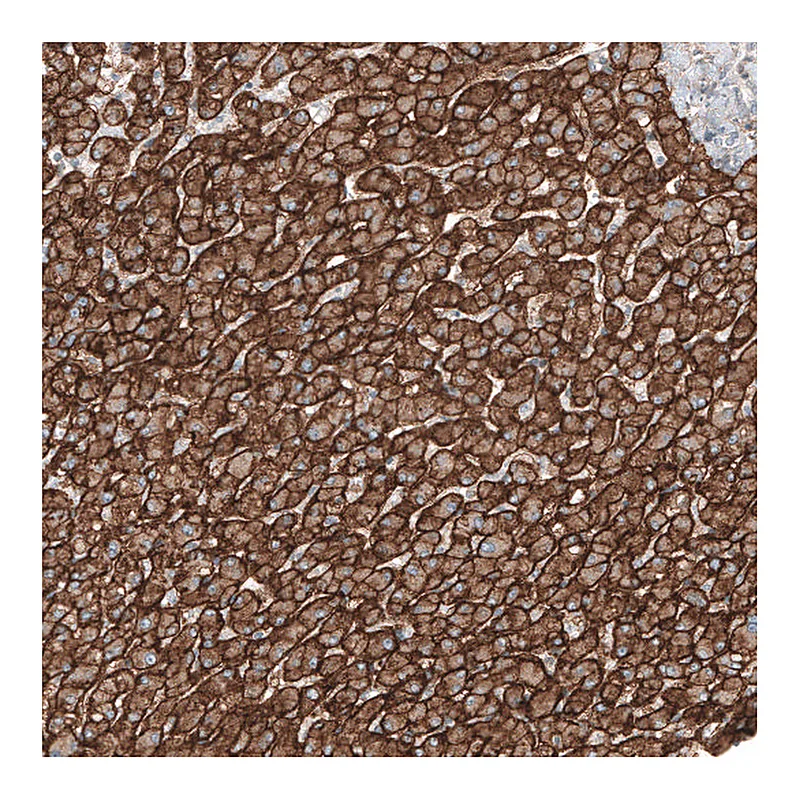 Atlas Antibodies Anti-SLC16A2 Antibody