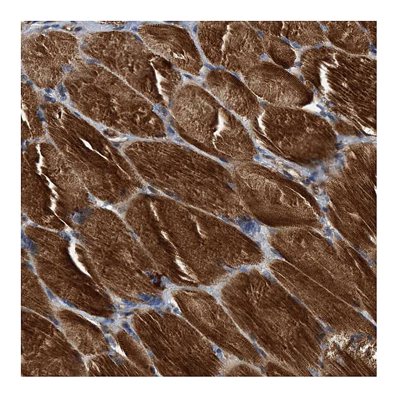 Atlas Antibodies Anti-SLC16A3 Antibody