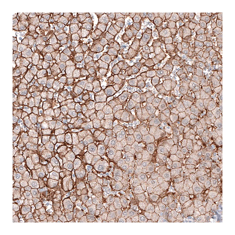 Atlas Antibodies Anti-SLC16A2 Antibody