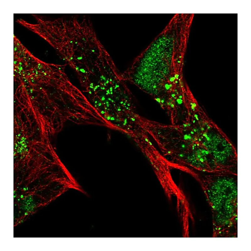 Atlas Antibodies Anti-SLC16A6 Antibody