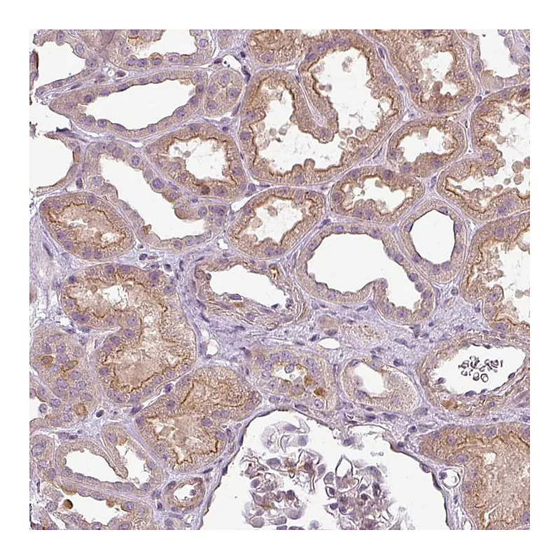 Atlas Antibodies Anti-SLC16A9 Antibody