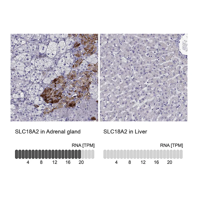 Atlas Antibodies Anti-SLC18A2 Antibody