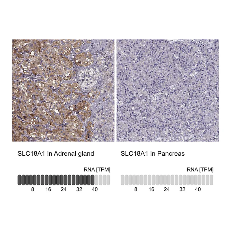 Atlas Antibodies Anti-SLC18A1 Antibody