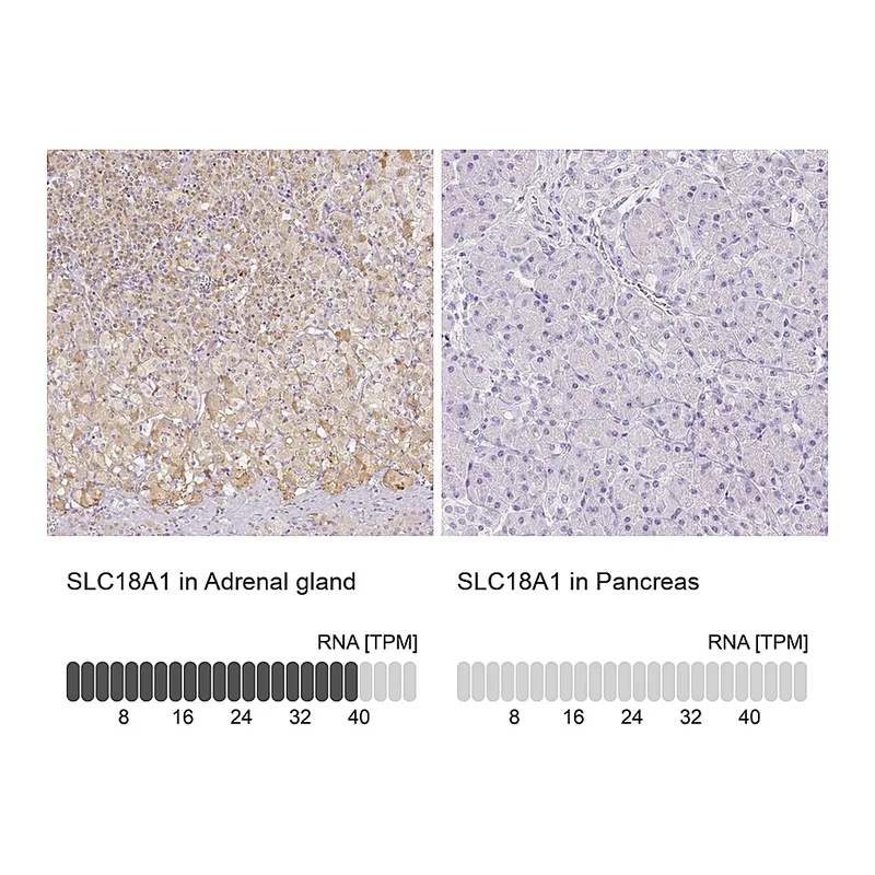 Atlas Antibodies Anti-SLC18A1 Antibody