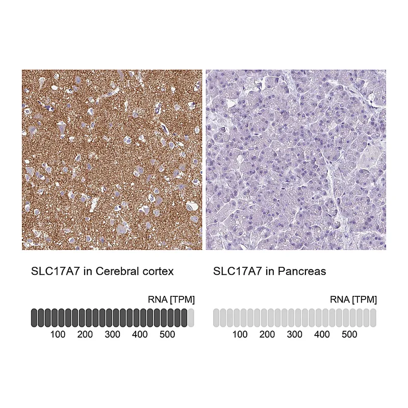 Atlas Antibodies Anti-SLC17A7 Antibody