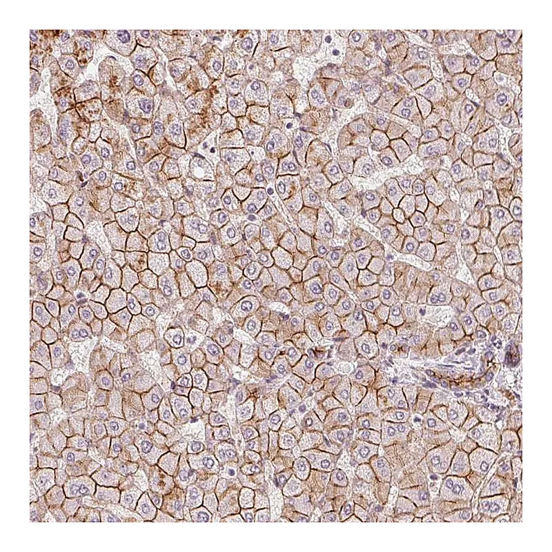Atlas Antibodies Anti-SLC17A4 Antibody