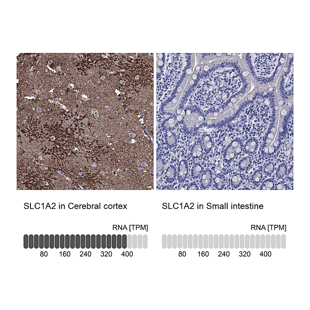 Atlas Antibodies Anti-SLC1A2 Antibody