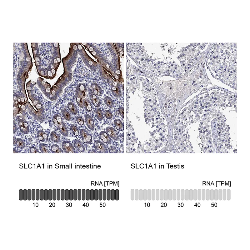 Atlas Antibodies Anti-SLC1A1 Antibody
