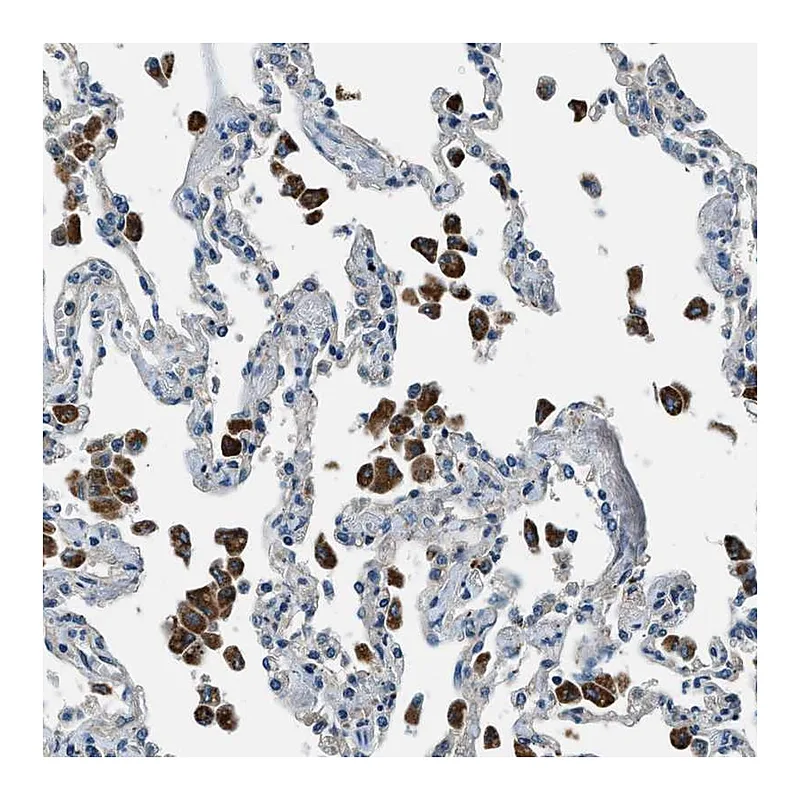 Atlas Antibodies Anti-SLC19A2 Antibody