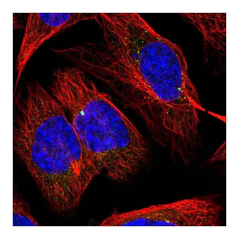 Atlas Antibodies Anti-SLC1A4 Antibody