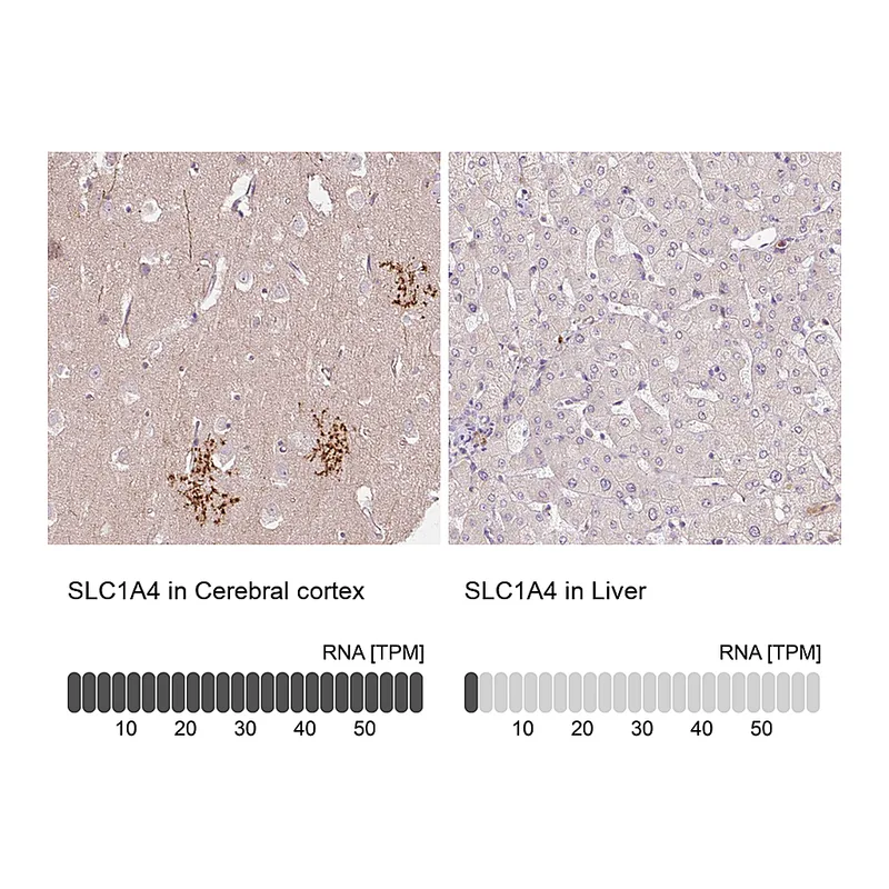 Atlas Antibodies Anti-SLC1A4 Antibody