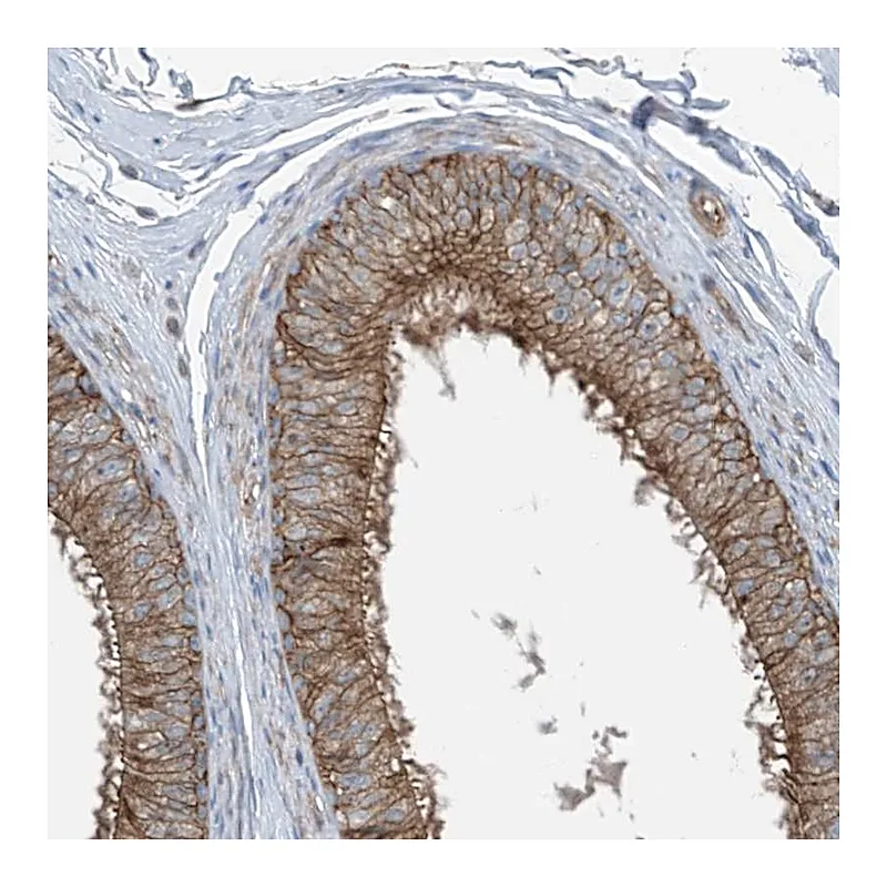 Atlas Antibodies Anti-SLC1A5 Antibody