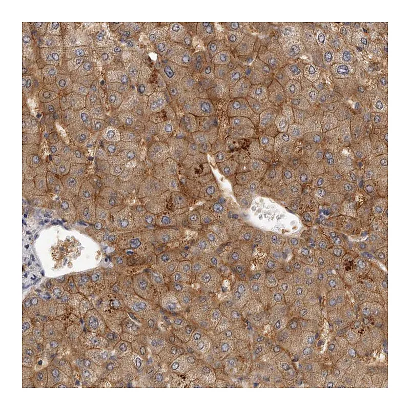 Atlas Antibodies Anti-SLC22A1 Antibody