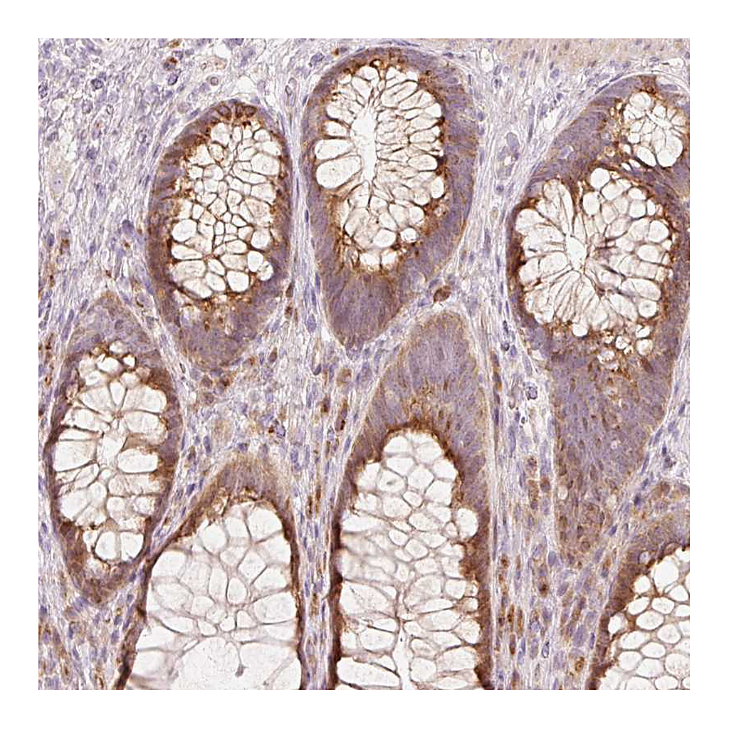Atlas Antibodies Anti-SLC20A1 Antibody