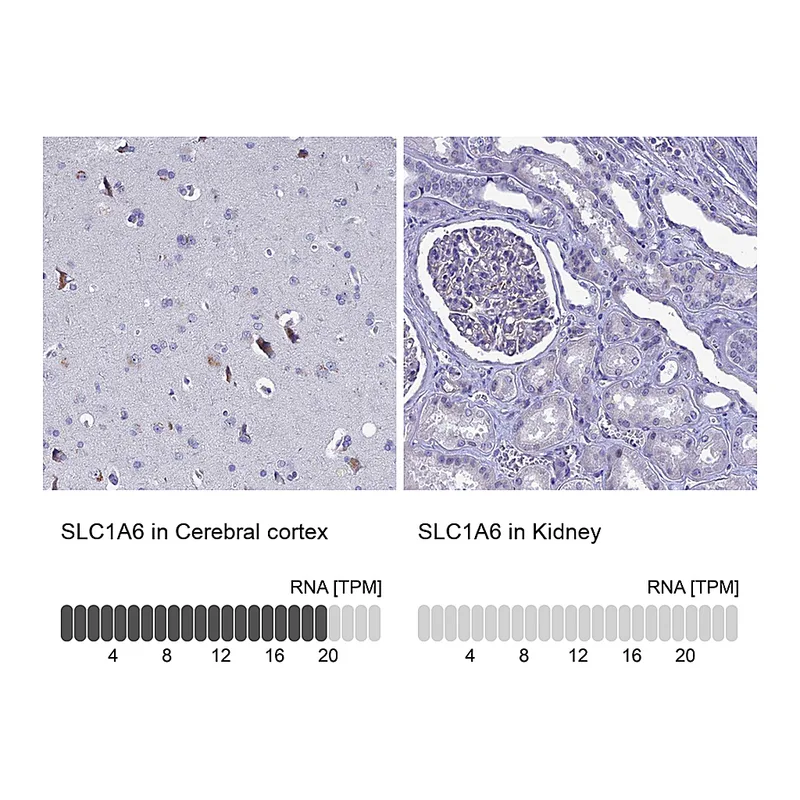 Atlas Antibodies Anti-SLC1A6 Antibody