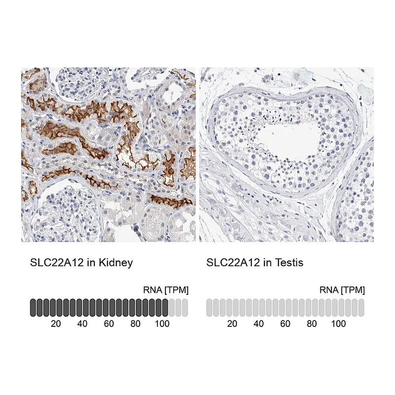 Atlas Antibodies Anti-SLC22A12 Antibody
