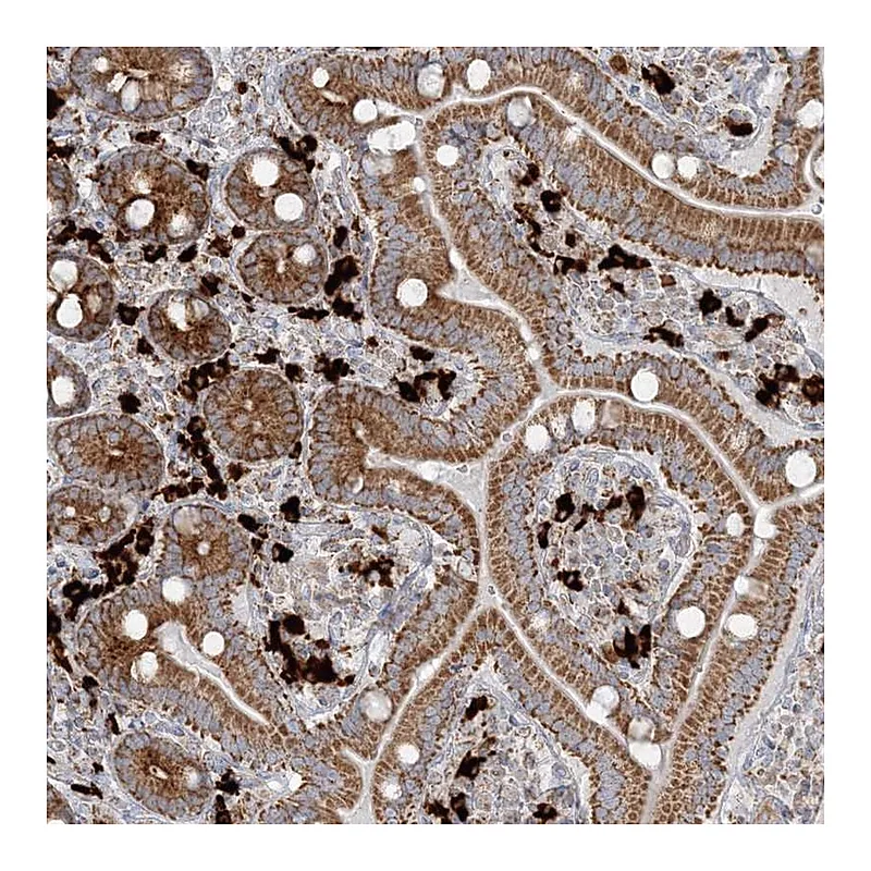 Atlas Antibodies Anti-SLC22A16 Antibody