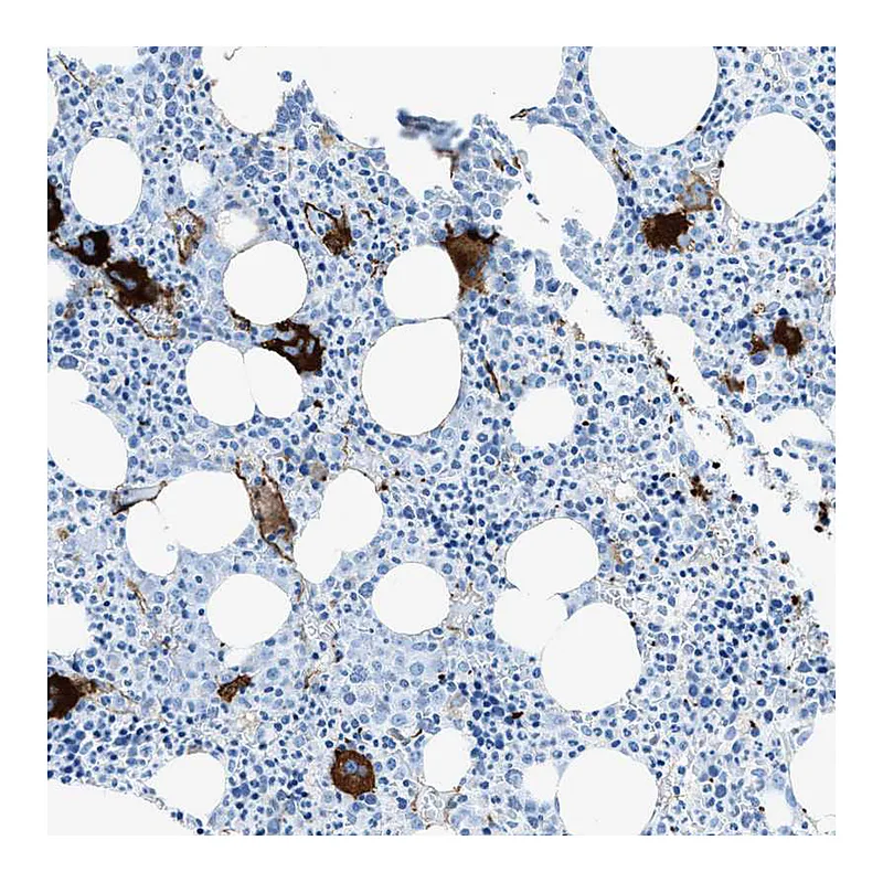 Atlas Antibodies Anti-SLC22A15 Antibody