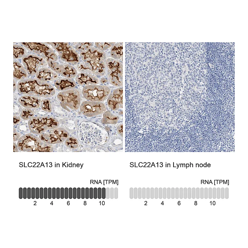 Atlas Antibodies Anti-SLC22A13 Antibody