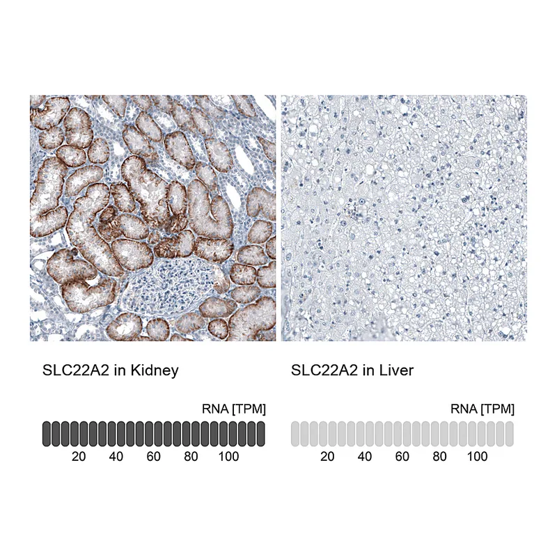 Atlas Antibodies Anti-SLC22A2 Antibody