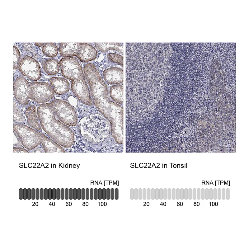 Atlas Antibodies Anti-SLC22A2 Antibody