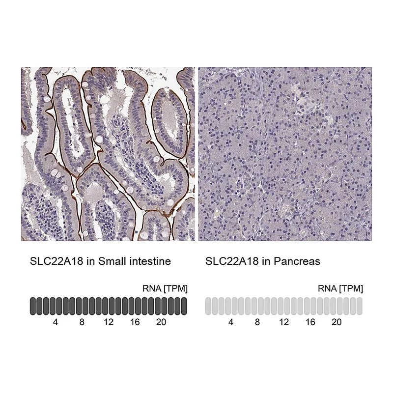 Atlas Antibodies Anti-SLC22A18 Antibody