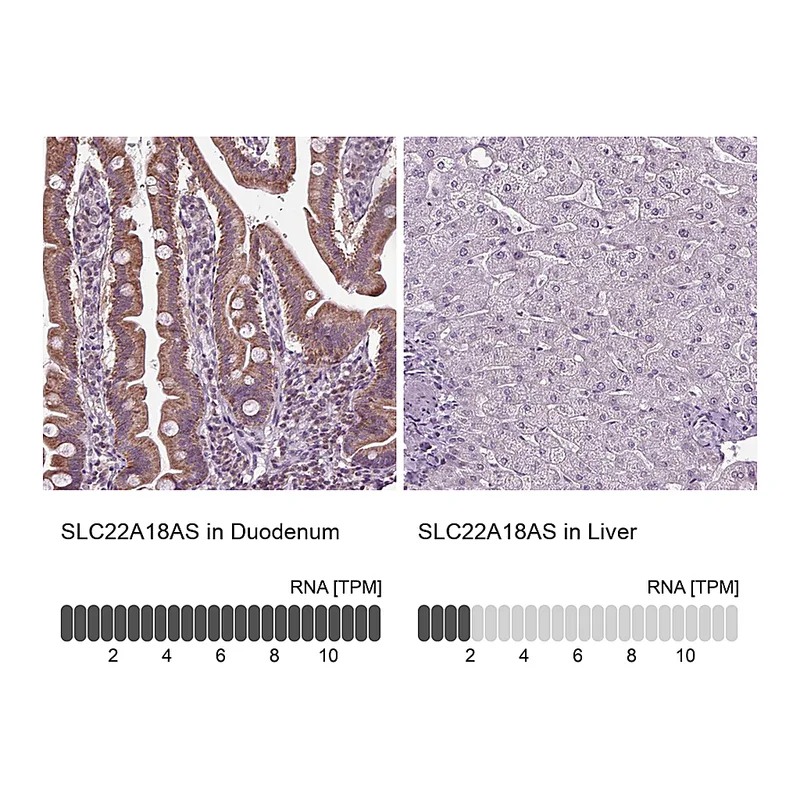 Atlas Antibodies Anti-SLC22A18AS Antibody