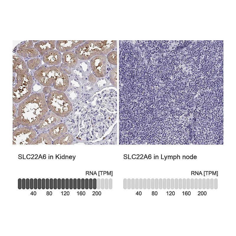 Atlas Antibodies Anti-SLC22A6 Antibody