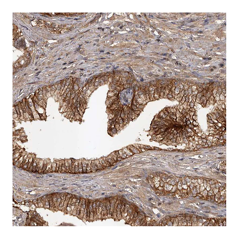 Atlas Antibodies Anti-SLC22A3 Antibody