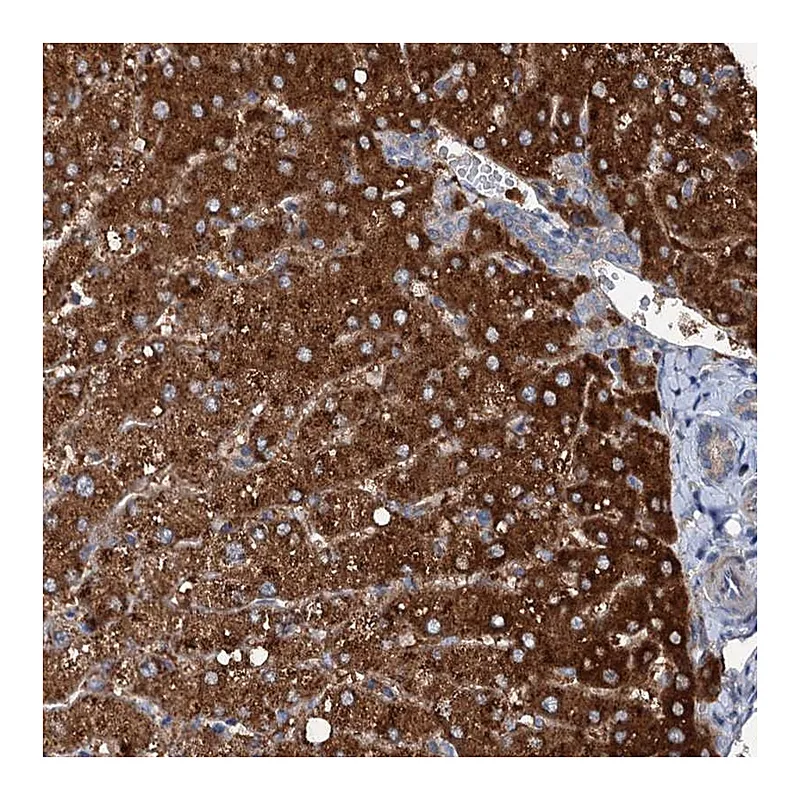 Atlas Antibodies Anti-SLC22A25 Antibody
