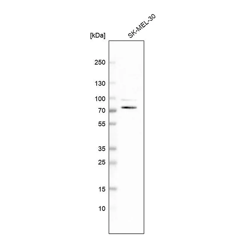Atlas Antibodies Anti-SLC23A2 Antibody