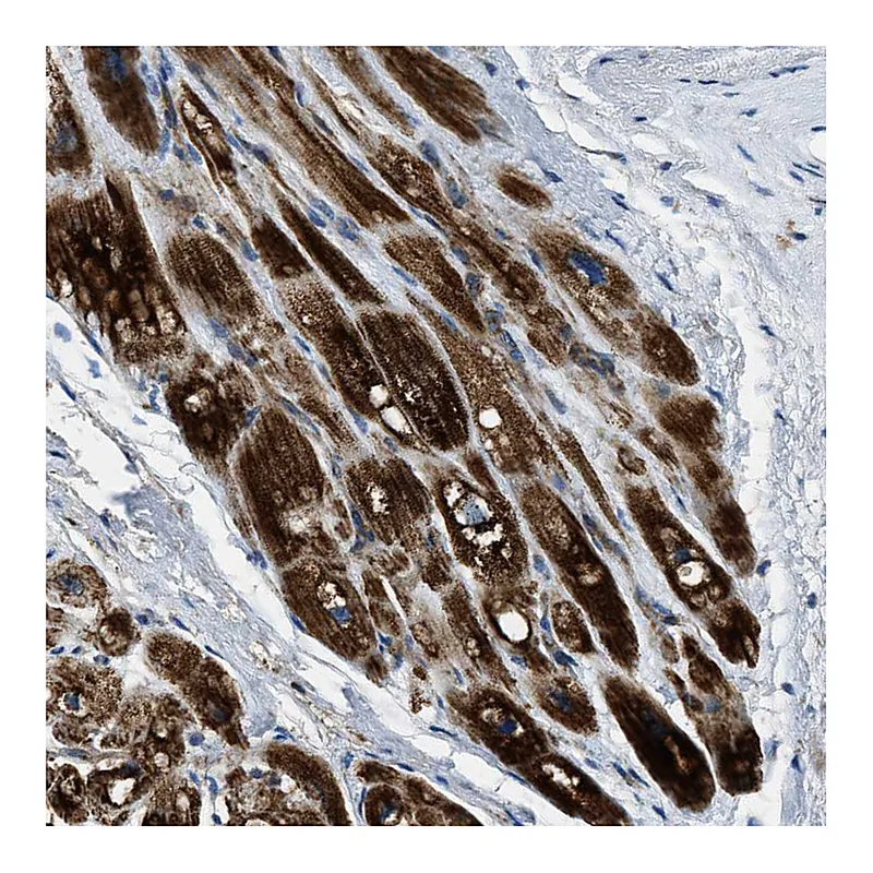 Atlas Antibodies Anti-SLC25A11 Antibody