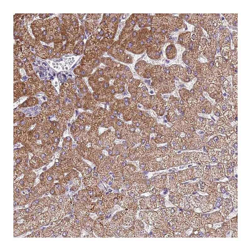 Atlas Antibodies Anti-SLC25A15 Antibody