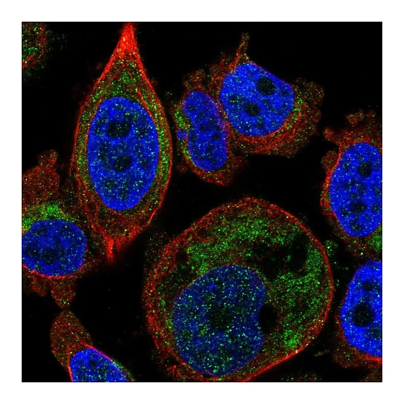 Atlas Antibodies Anti-SLC25A16 Antibody