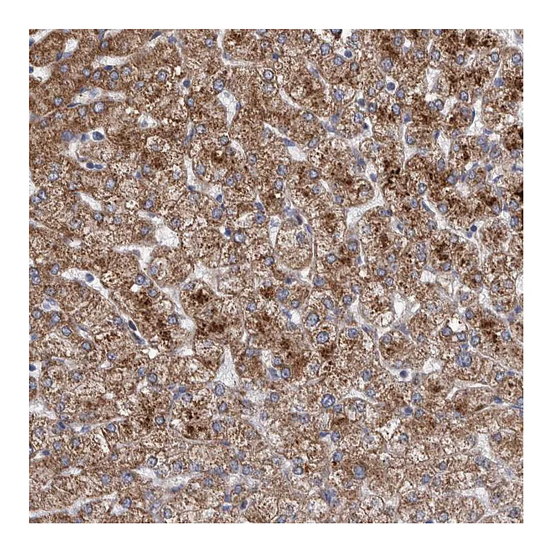 Atlas Antibodies Anti-SLC25A10 Antibody