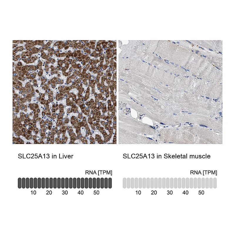Atlas Antibodies Anti-SLC25A13 Antibody