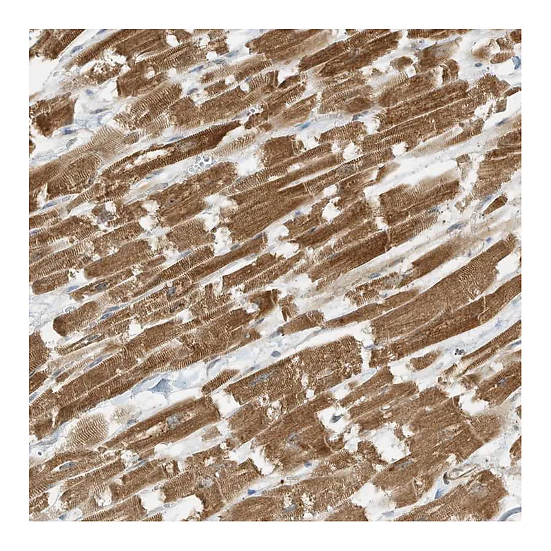 Atlas Antibodies Anti-SLC25A12 Antibody